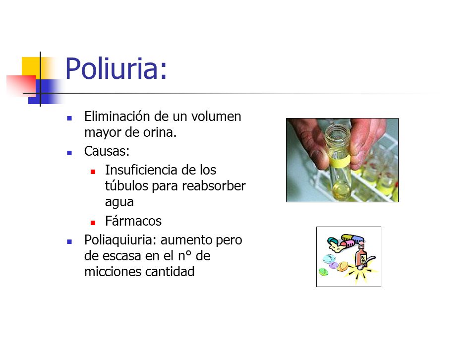 Poliuria: Eliminación de un volumen mayor de orina. Causas: