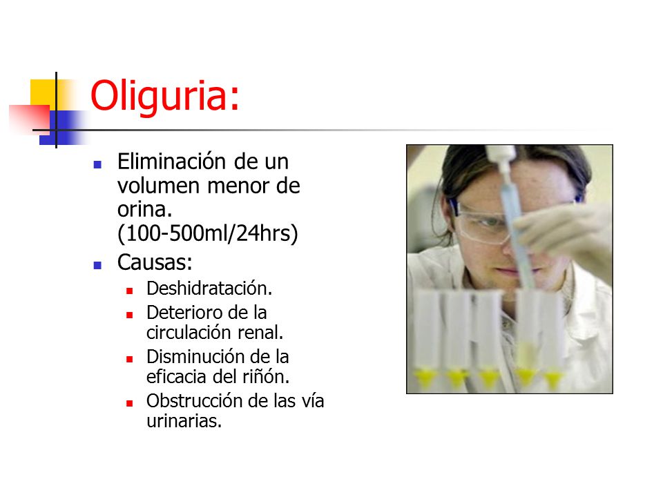 Oliguria: Eliminación de un volumen menor de orina. ( ml/24hrs)