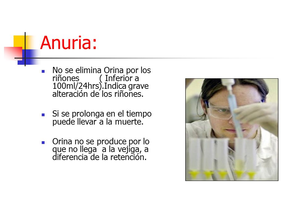Anuria: No se elimina Orina por los riñones ( Inferior a 100ml/24hrs).Indica grave alteración de los riñones.