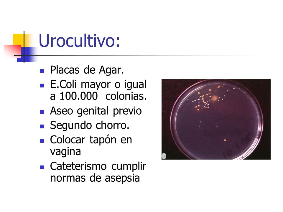 Urocultivo: Placas de Agar. E.Coli mayor o igual a colonias.