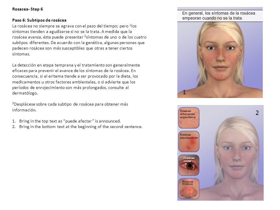 1 2 Rosacea- Step 6 Paso 6: Subtipos de rosácea