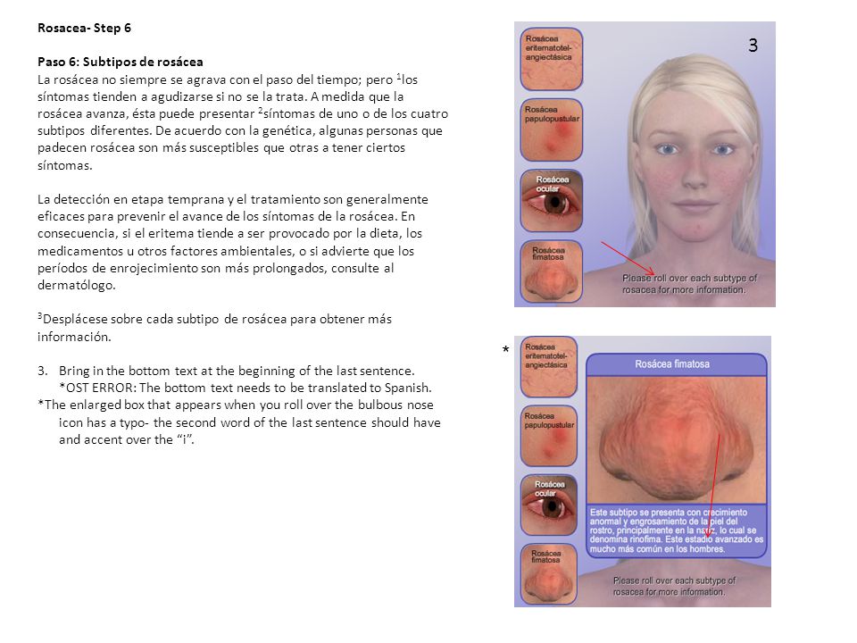 3 * Rosacea- Step 6 Paso 6: Subtipos de rosácea