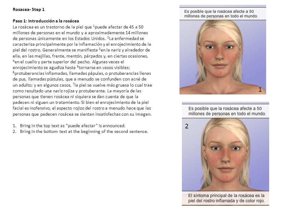 1 2 Rosacea- Step 1 Paso 1: Introducción a la rosácea
