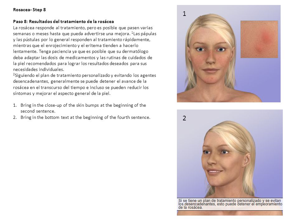 1 2 Rosacea- Step 8 Paso 8: Resultados del tratamiento de la rosácea