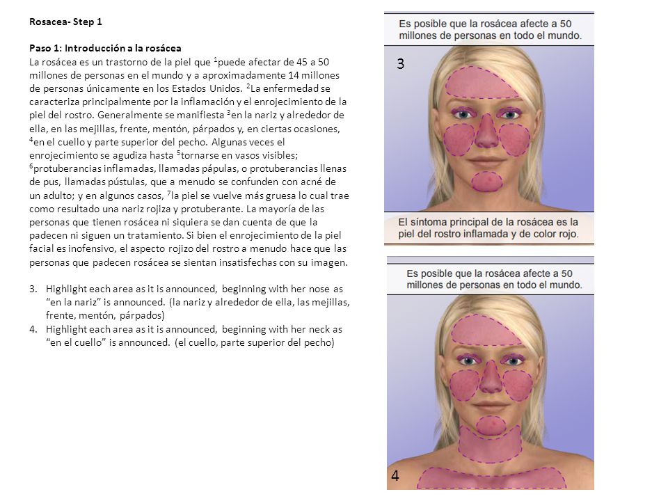 3 4 Rosacea- Step 1 Paso 1: Introducción a la rosácea