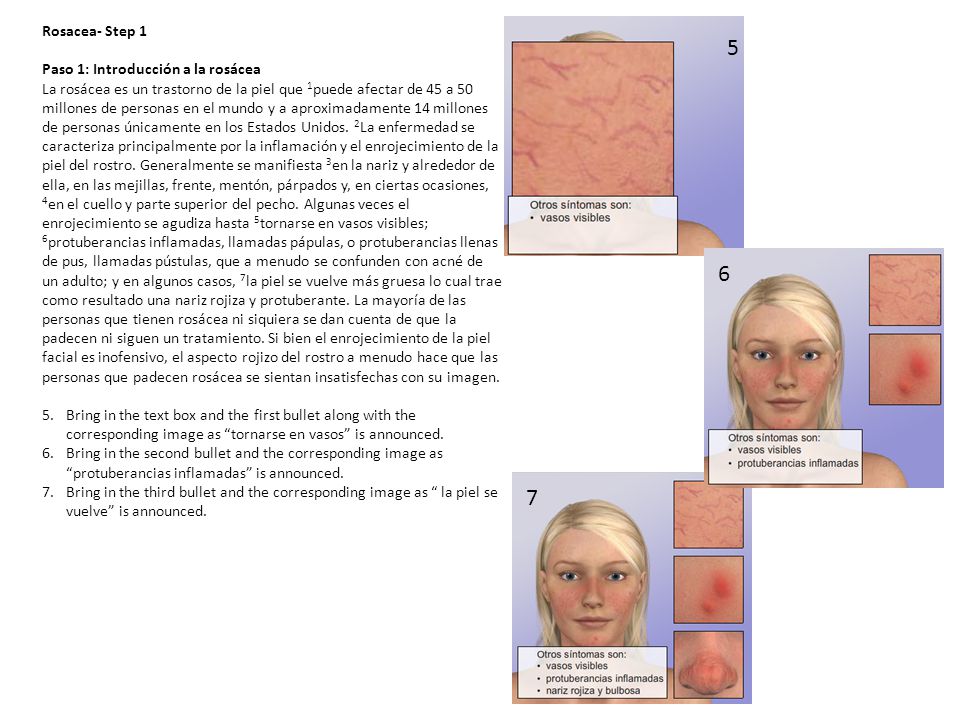 5 6 7 Rosacea- Step 1 Paso 1: Introducción a la rosácea