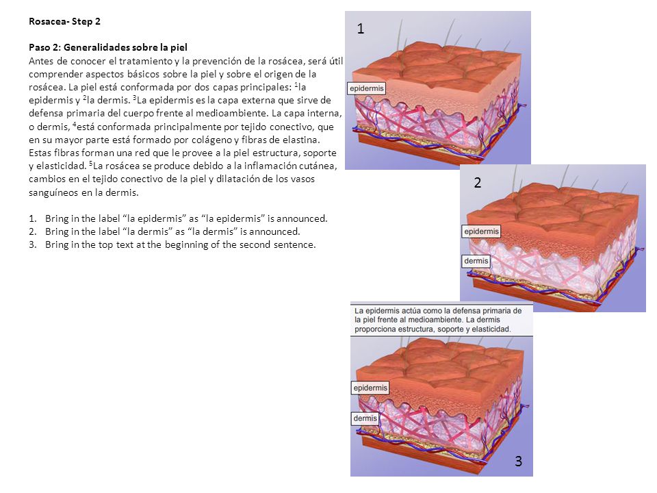 1 2 3 Rosacea- Step 2 Paso 2: Generalidades sobre la piel