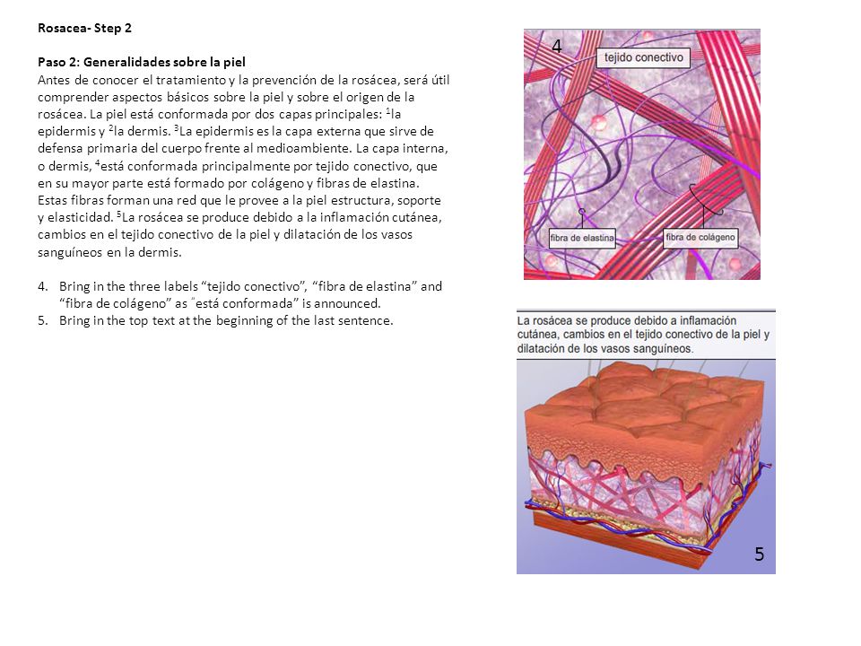 4 5 Rosacea- Step 2 Paso 2: Generalidades sobre la piel