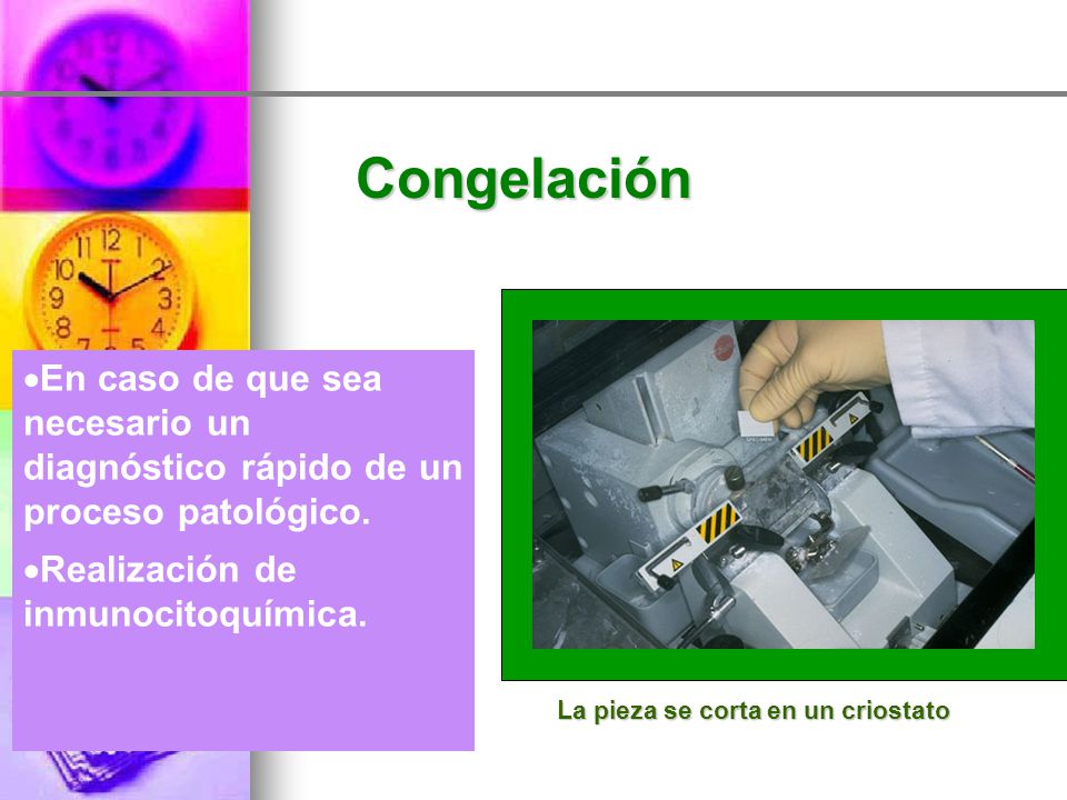 Congelación En caso de que sea necesario un diagnóstico rápido de un proceso patológico. Realización de inmunocitoquímica.