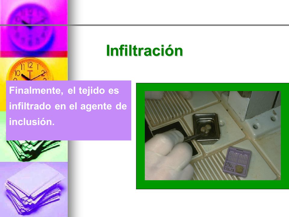 Infiltración Finalmente, el tejido es infiltrado en el agente de inclusión.