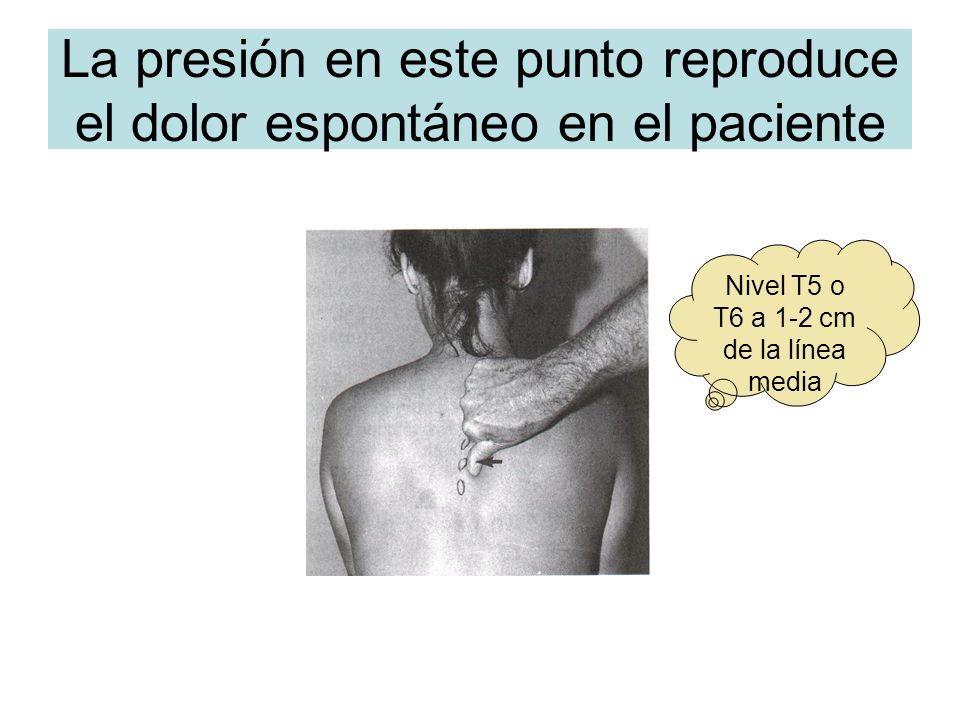 La presión en este punto reproduce el dolor espontáneo en el paciente