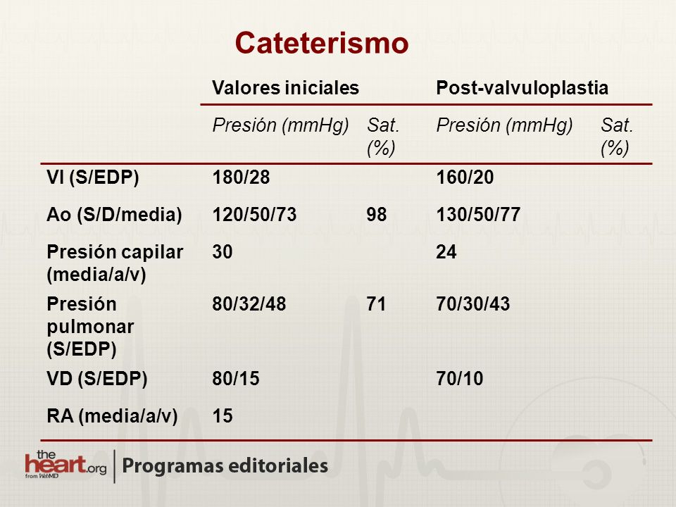 Cateterismo Valores iniciales Post-valvuloplastia Presión (mmHg)