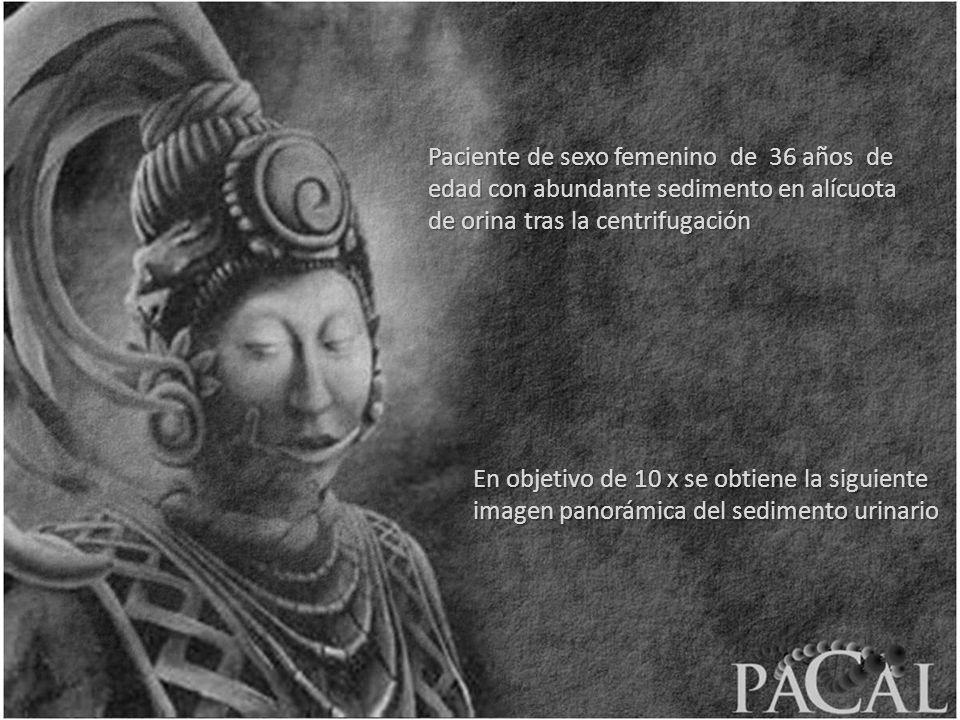 Paciente de sexo femenino de 36 años de