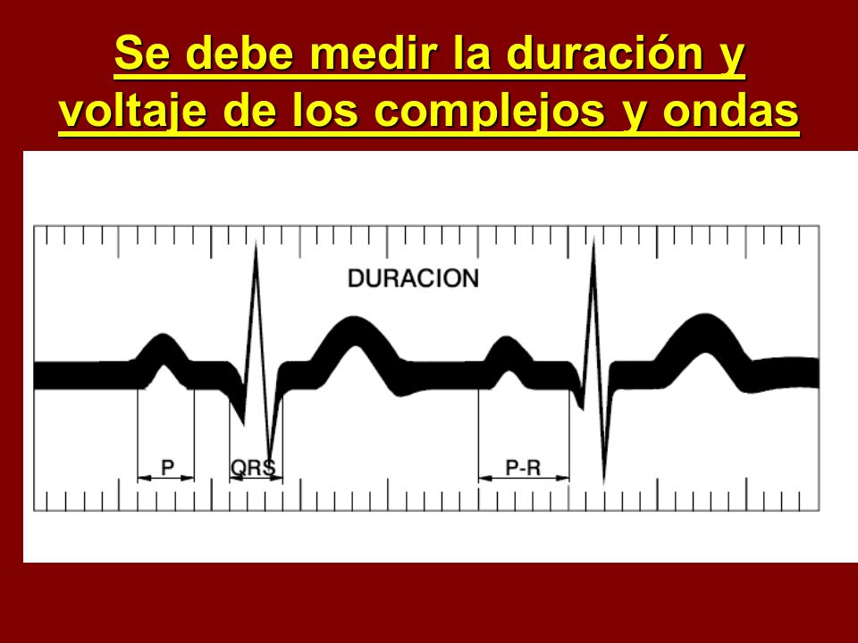 Se debe medir la duración y voltaje de los complejos y ondas