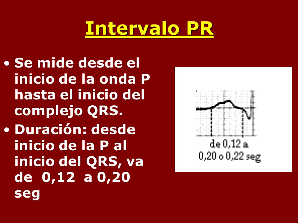 Intervalo PR Se mide desde el inicio de la onda P hasta el inicio del complejo QRS.