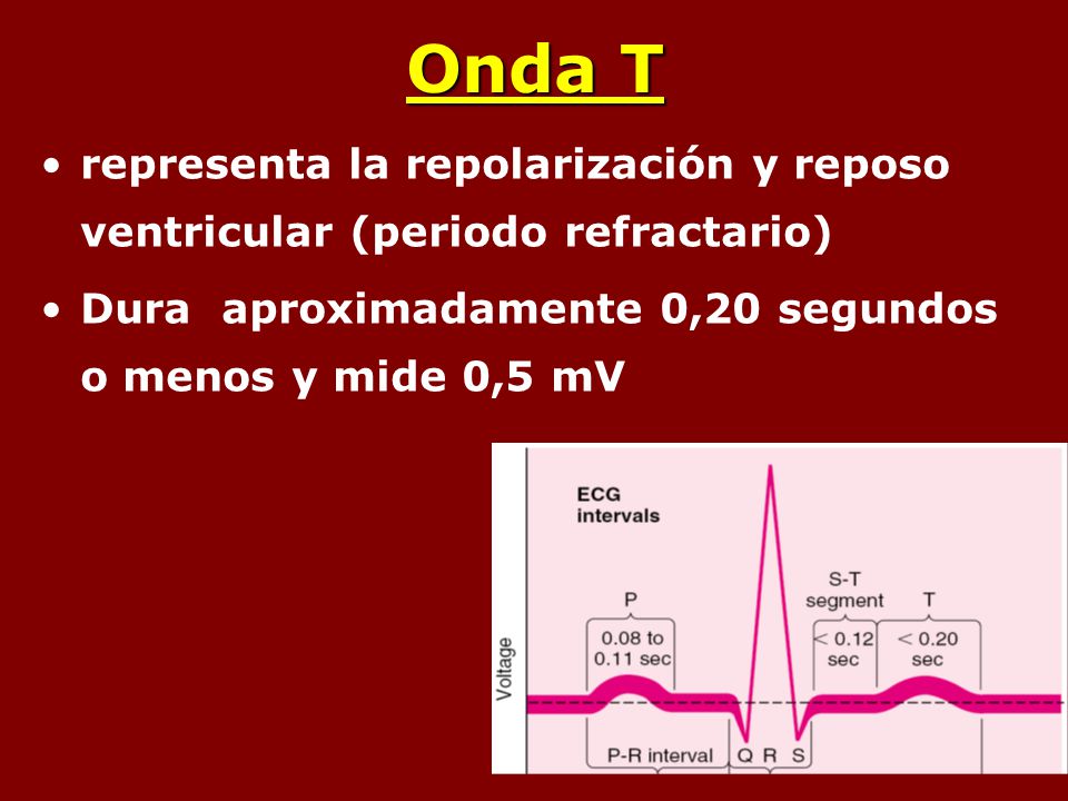 Onda T representa la repolarización y reposo ventricular (periodo refractario) Dura aproximadamente 0,20 segundos o menos y mide 0,5 mV.