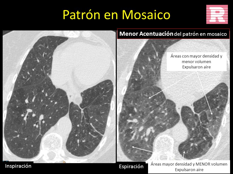 Patrón en Mosaico Menor Acentuación del patrón en mosaico Inspiración