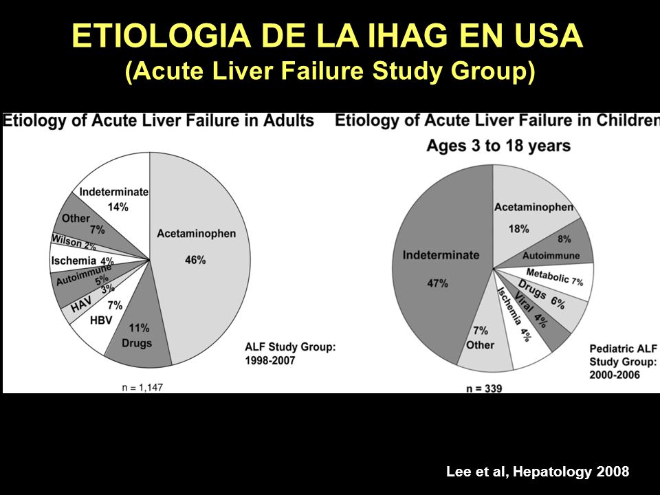 ETIOLOGIA DE LA IHAG EN USA (Acute Liver Failure Study Group)