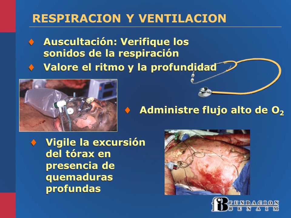 RESPIRACION Y VENTILACION