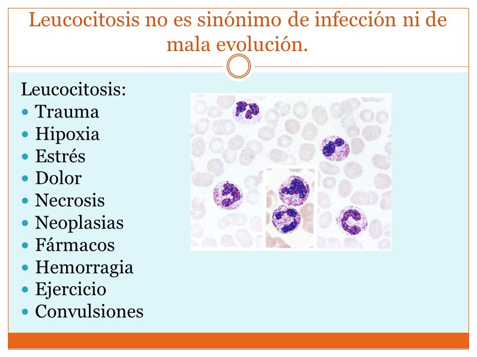 Leucocitosis no es sinónimo de infección ni de mala evolución.