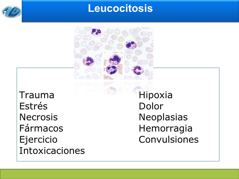 Leucocitosis Leucocitosis no es sinónimo de infección ni de mala evolución.