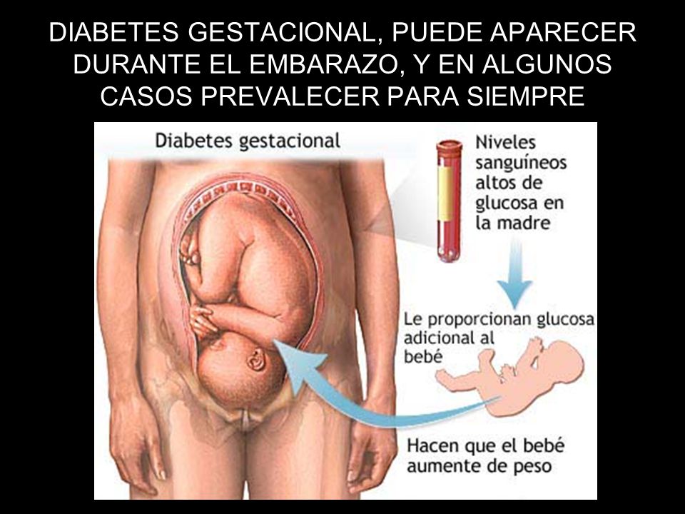 DIABETES GESTACIONAL, PUEDE APARECER DURANTE EL EMBARAZO, Y EN ALGUNOS CASOS PREVALECER PARA SIEMPRE