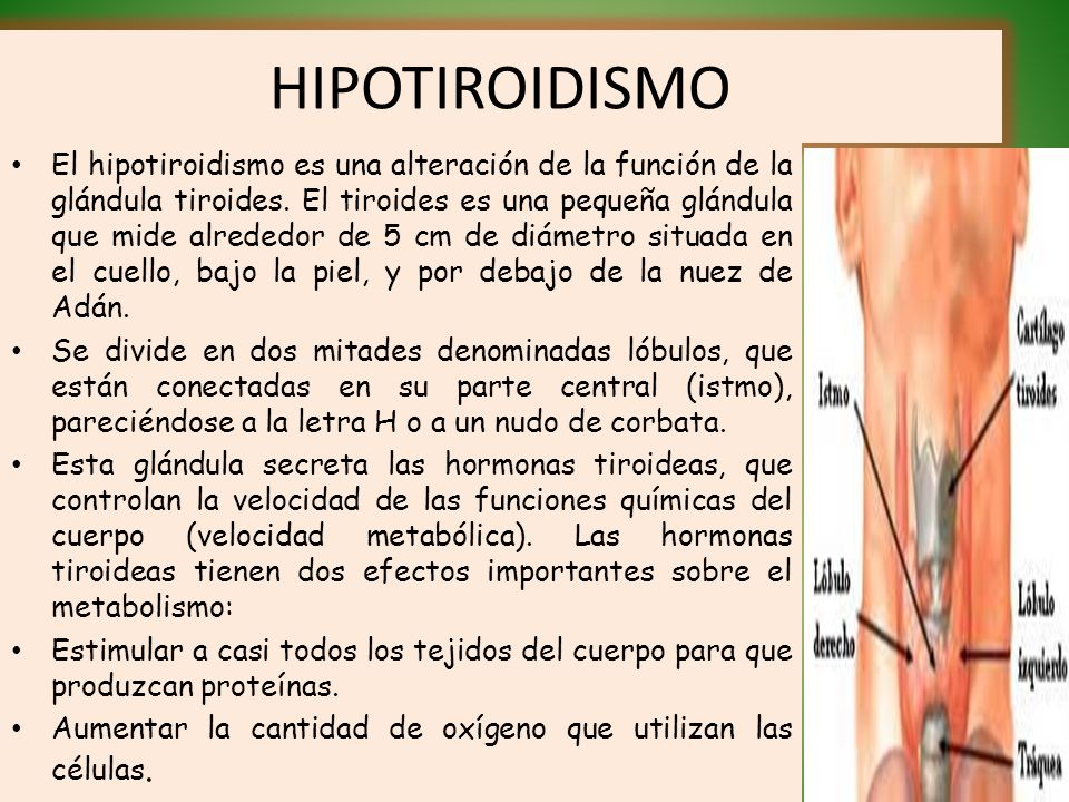 Sal yodada para el hipotiroidismo