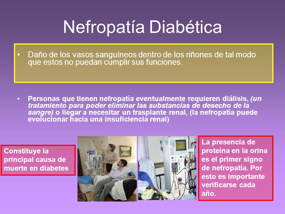 Nefropatía Diabética Daño de los vasos sanguíneos dentro de los riñones de tal modo que estos no puedan cumplir sus funciones.