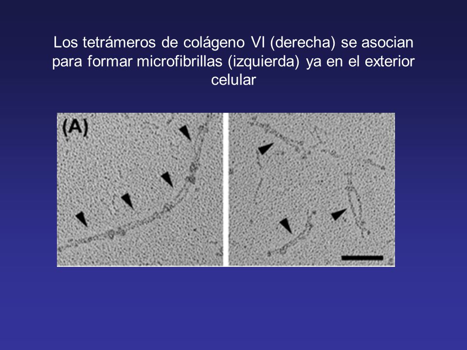 Los tetrámeros de colágeno VI (derecha) se asocian para formar microfibrillas (izquierda) ya en el exterior celular