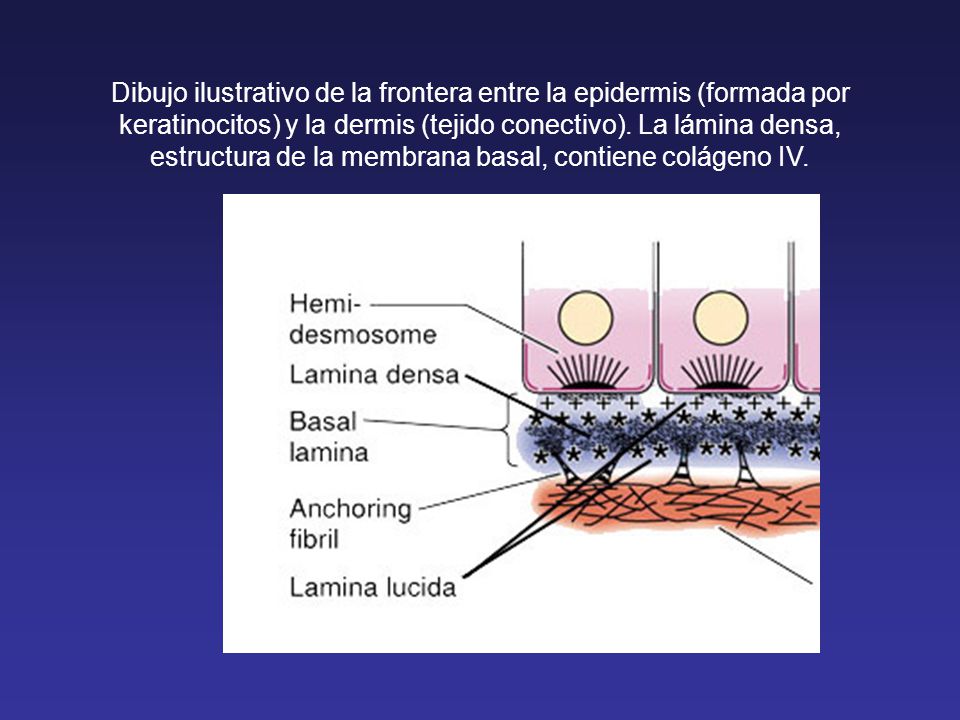 Dibujo ilustrativo de la frontera entre la epidermis (formada por keratinocitos) y la dermis (tejido conectivo).