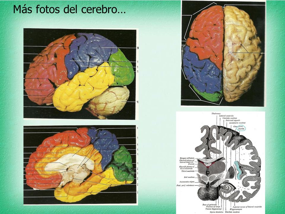 Más fotos del cerebro… Perfil izquierdo, desde arriba, cara interna del hemisferio derecho (corte sagital), corte coronal.