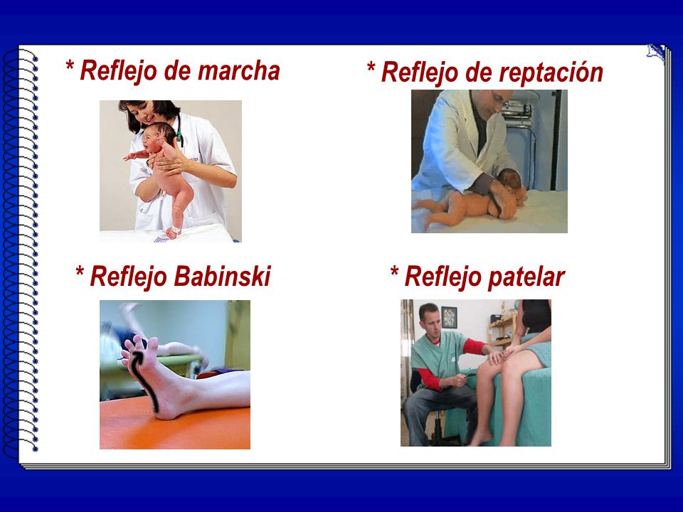 * Reflejo de marcha * Reflejo de reptación * Reflejo Babinski * Reflejo patelar