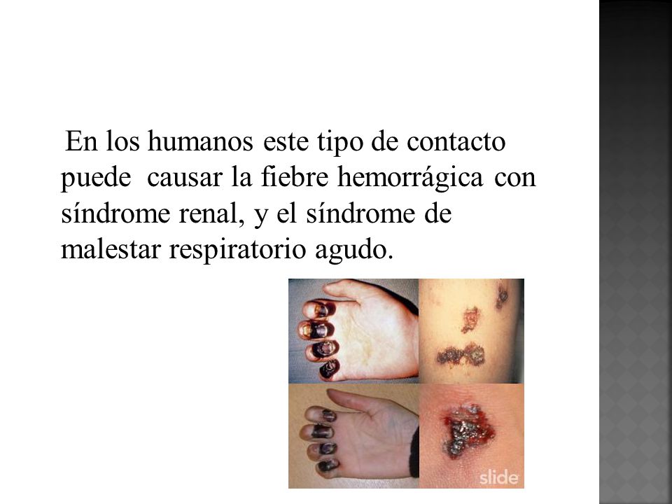 En los humanos este tipo de contacto puede causar la fiebre hemorrágica con síndrome renal, y el síndrome de malestar respiratorio agudo.