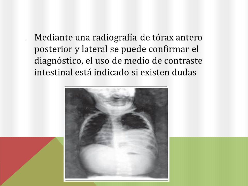 . Mediante una radiografía de tórax antero posterior y lateral se puede confirmar el diagnóstico, el uso de medio de contraste intestinal está indicado si existen dudas