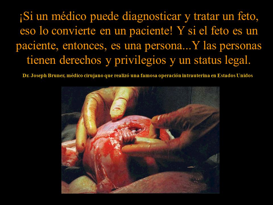 ¡Si un médico puede diagnosticar y tratar un feto, eso lo convierte en un paciente! Y si el feto es un paciente, entonces, es una persona...Y las personas tienen derechos y privilegios y un status legal.