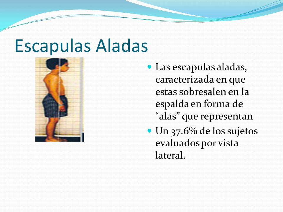 Escapulas Aladas Las escapulas aladas, caracterizada en que estas sobresalen en la espalda en forma de alas que representan.