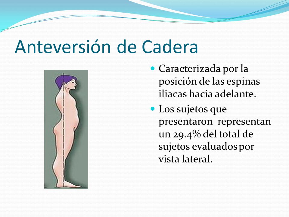 Anteversión de Cadera Caracterizada por la posición de las espinas iliacas hacia adelante.