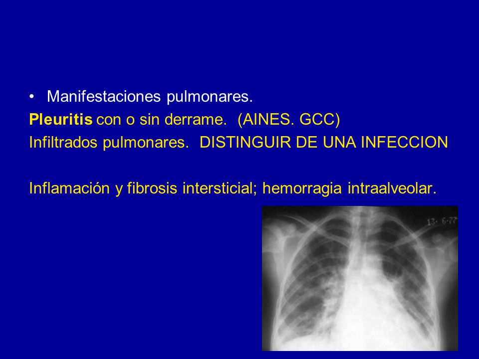 Manifestaciones pulmonares.