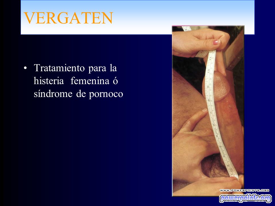 VERGATEN Tratamiento para la histeria femenina ó síndrome de pornoco