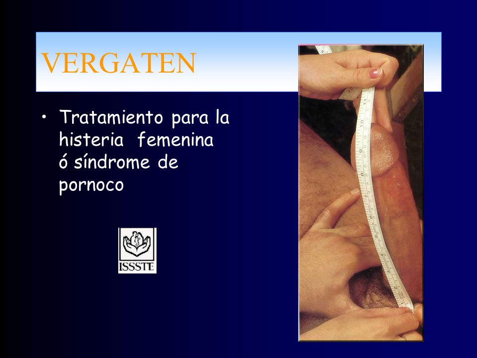 VERGATEN Tratamiento para la histeria femenina ó síndrome de pornoco