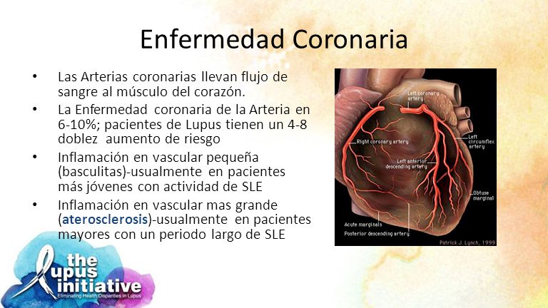 Enfermedad Coronaria Las Arterias coronarias llevan flujo de sangre al músculo del corazón.