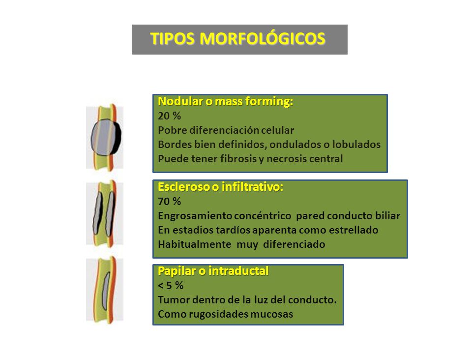 TIPOS MORFOLÓGICOS Nodular o mass forming: Escleroso o infiltrativo: