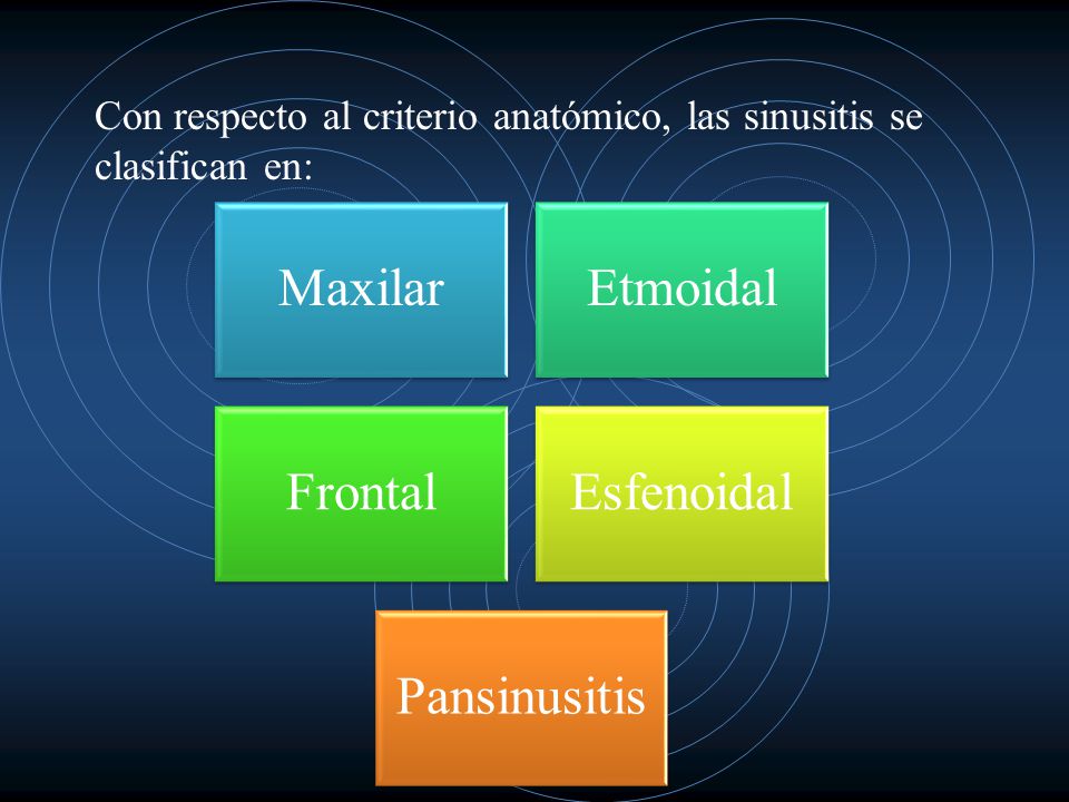 Con respecto al criterio anatómico, las sinusitis se clasifican en: