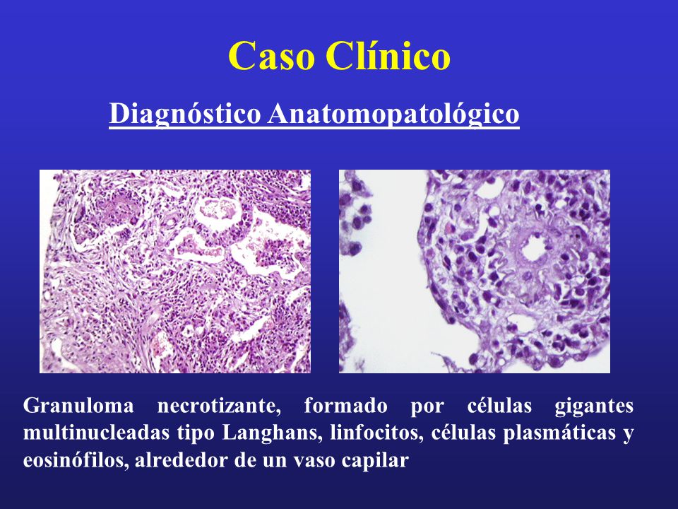 Diagnóstico Anatomopatológico