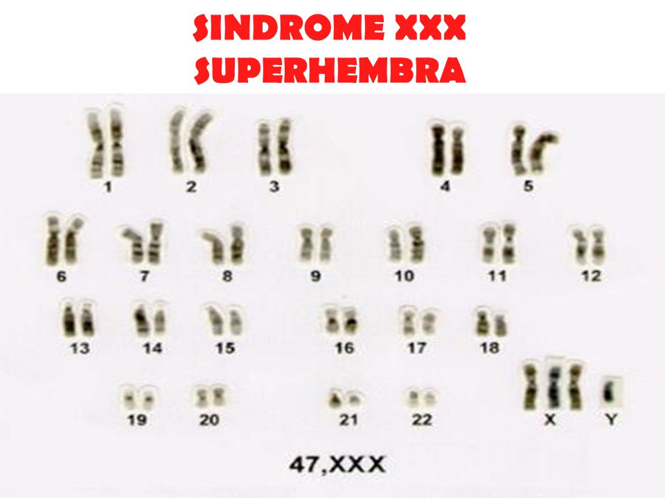 SINDROME XXX SUPERHEMBRA