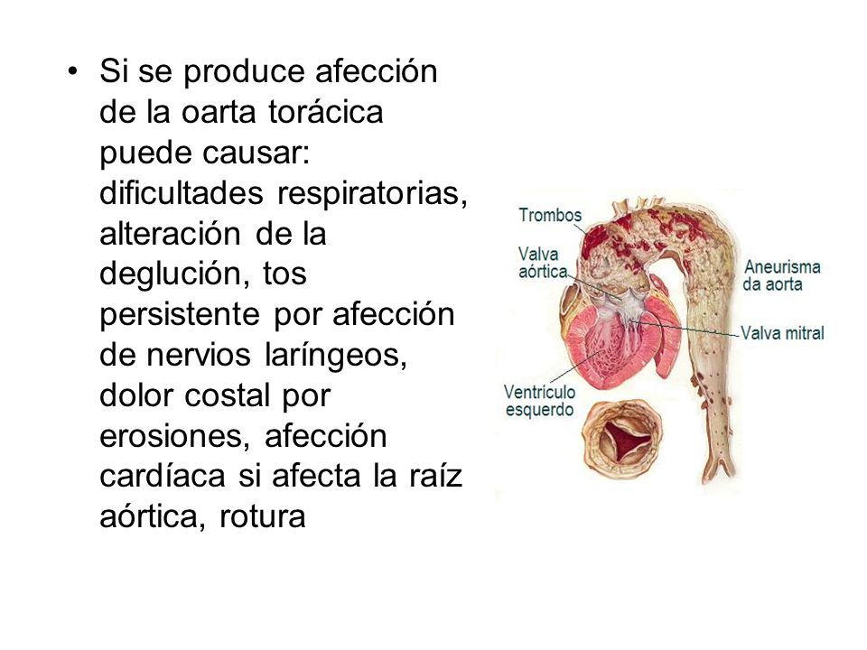 Si se produce afección de la oarta torácica puede causar: dificultades respiratorias, alteración de la deglución, tos persistente por afección de nervios laríngeos, dolor costal por erosiones, afección cardíaca si afecta la raíz aórtica, rotura