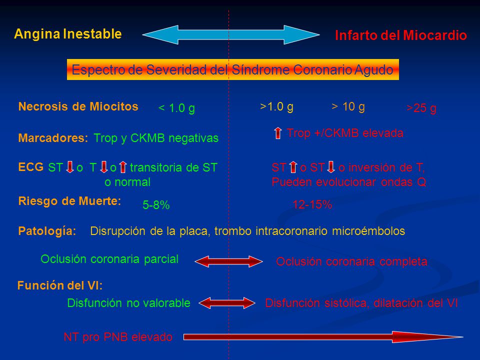 Espectro de Severidad del Síndrome Coronario Agudo