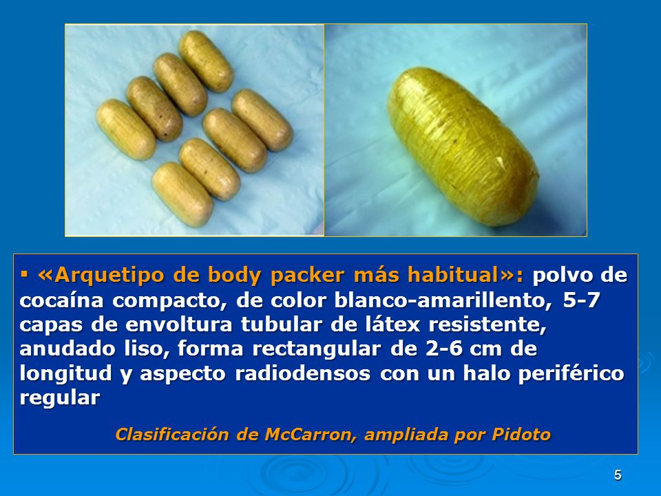 ▪ «Arquetipo de body packer más habitual»: polvo de cocaína compacto, de color blanco-amarillento, 5-7 capas de envoltura tubular de látex resistente, anudado liso, forma rectangular de 2-6 cm de longitud y aspecto radiodensos con un halo periférico regular