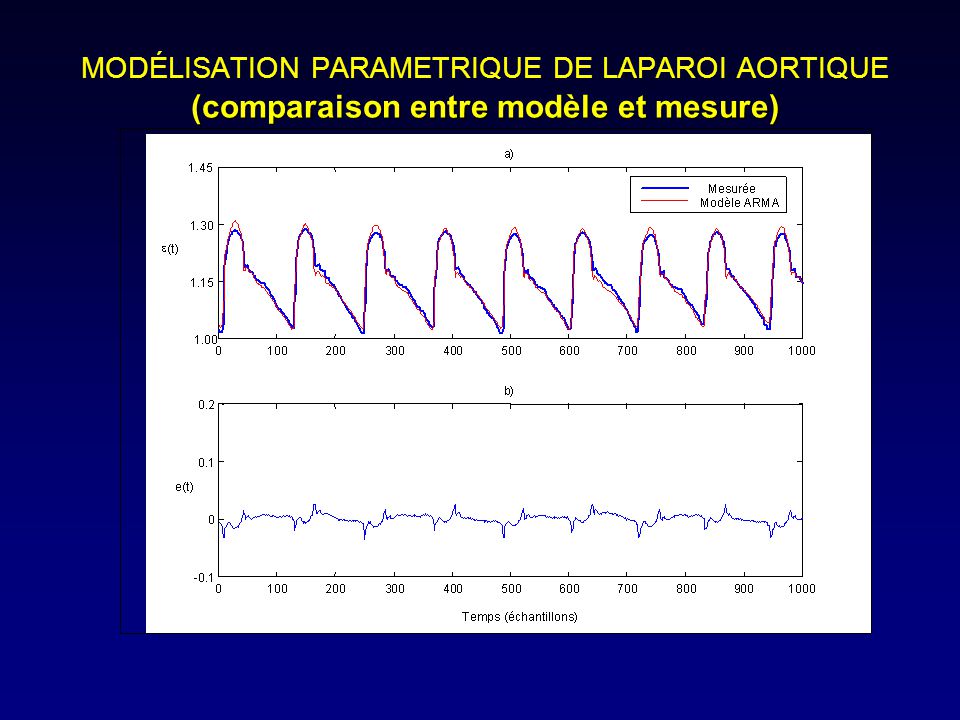 MODÉLISATION PARAMETRIQUE DE LAPAROI AORTIQUE (comparaison entre modèle et mesure)