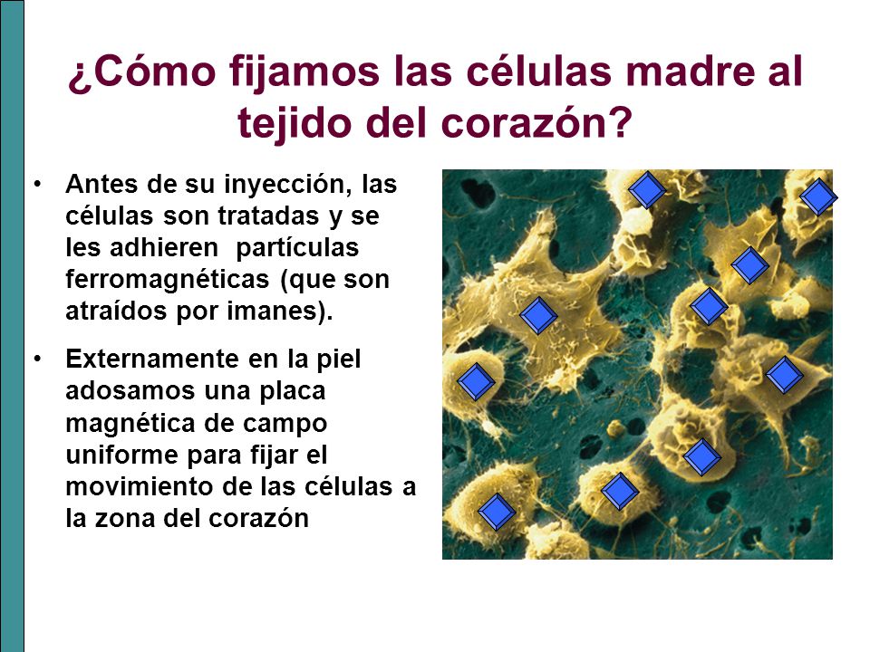 ¿Cómo fijamos las células madre al tejido del corazón